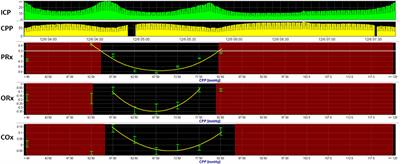 Approaches to Multimodality Monitoring in Pediatric Traumatic Brain Injury